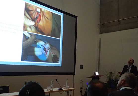 Diamond Piezo Ultrasonic Rhinoplasty.   Dr Mireas at Regensburg Annual Congress of European Academy of Facial Plastic Surgery 2018