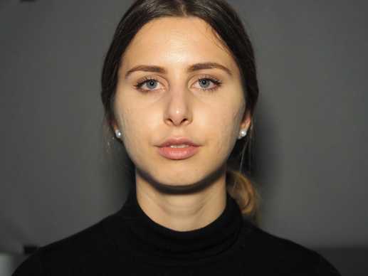 photo before the operation